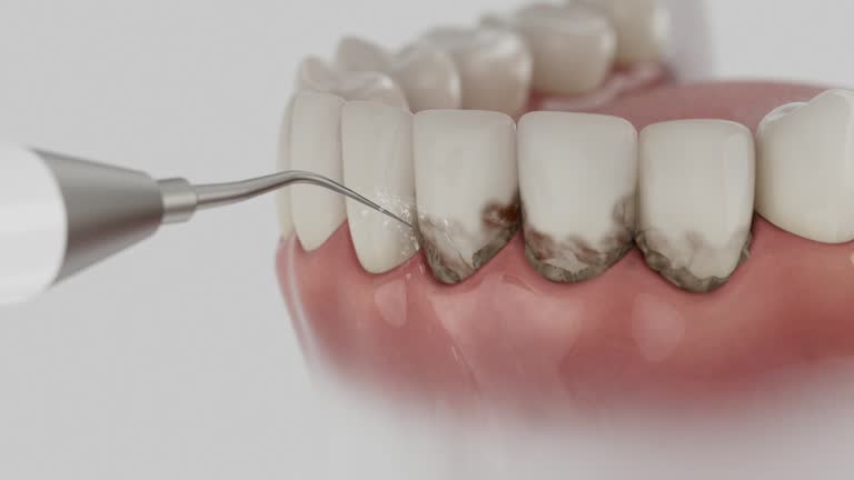 Trusted Teeth Cleaning And Checkup service in SUNY Oswego, NY - Dentist Open Now